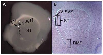 Embryonic Cerebrospinal Fluid Increases Neurogenic Activity in the Brain Ventricular-Subventricular Zone of Adult Mice